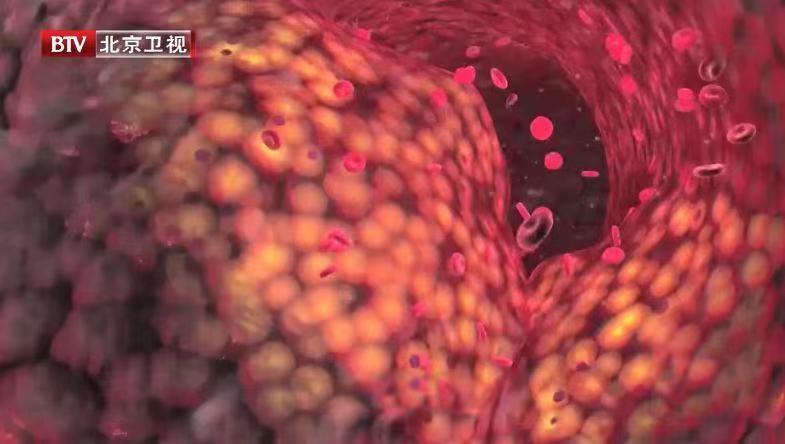 头痛的“元凶”终于找到了！痛在哪里，病因在哪儿？一文都告知你