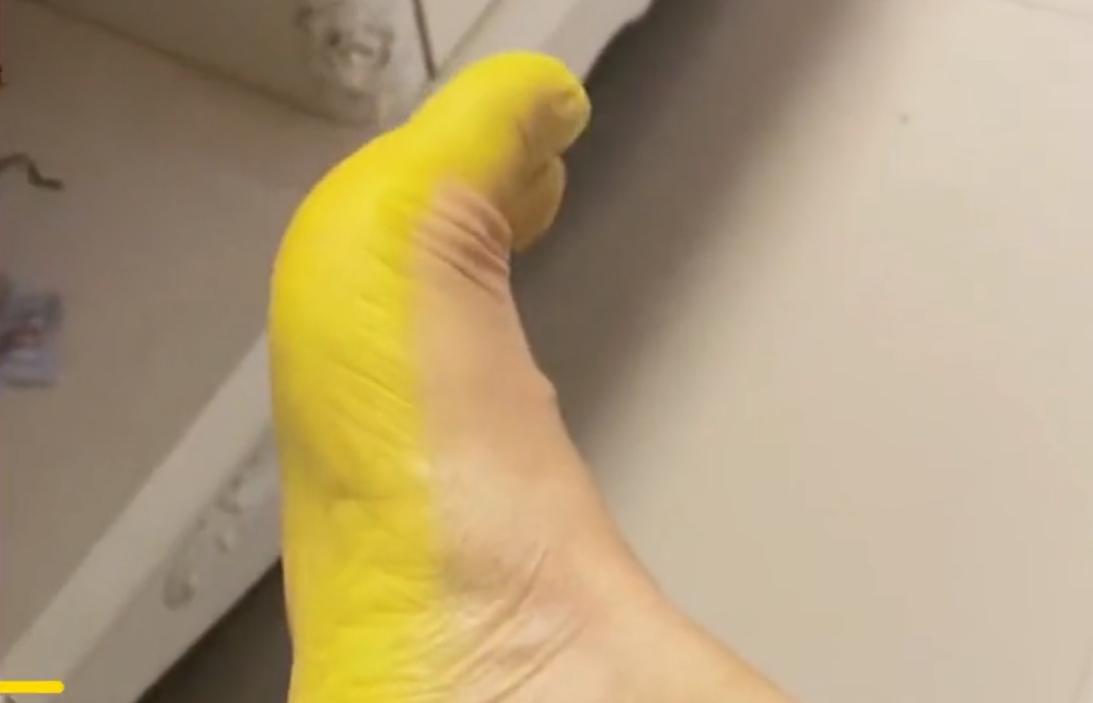 一女子夜市买双袜子，穿一天整个脚底被染黄！网友看后却直呼赚了