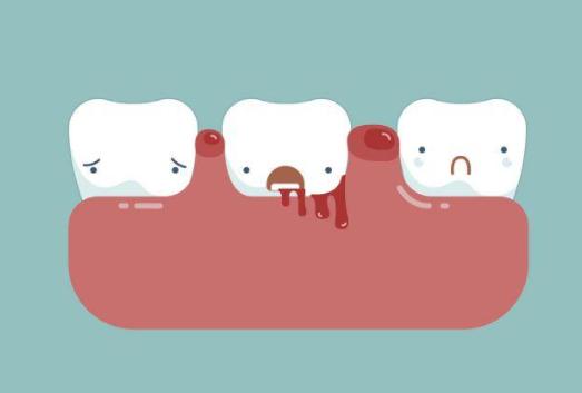 使用电动牙刷的好处与坏处,长期使用电动牙刷的危害弊端