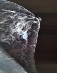 42岁女性体检应该检查哪些,45岁的女人体检项目