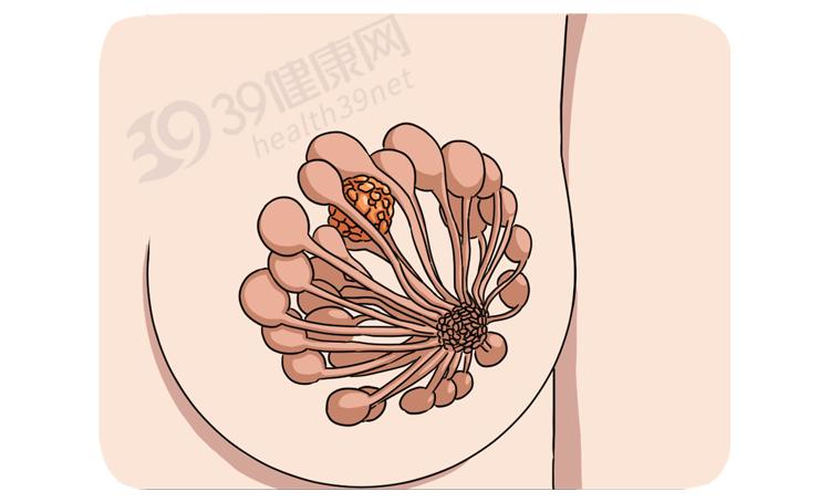 一针抗癌药可治哪几种癌,治愈恶性肿瘤癌症的真正手段