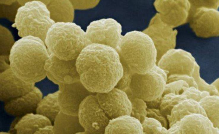 世界上最致命的病毒九种,细菌和病毒哪个更致命