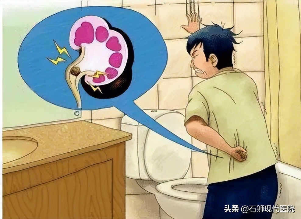 输尿管结石一直痛说明是在下滑吗,痛得要死的结石