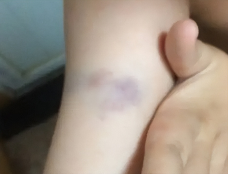 筋膜枪排行榜前十名2023,筋膜枪十大品牌怎么选