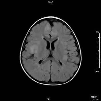 远程会诊让群众在家门口看名医,北京看儿童癫痫病哪一家最好