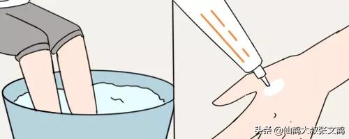 手脚裂口怎么快速消除,手脚冬天裂口怎么治疗效果好