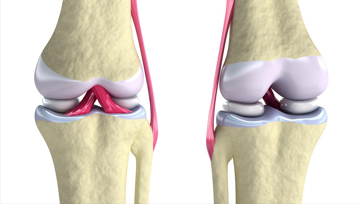 那些每天都走1万到2万步的人，最后都怎样了？医生：或有3种后果