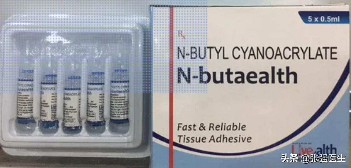 生物电疗可以治疗下肢静脉曲张,射频技术治疗下肢静脉曲张缺点