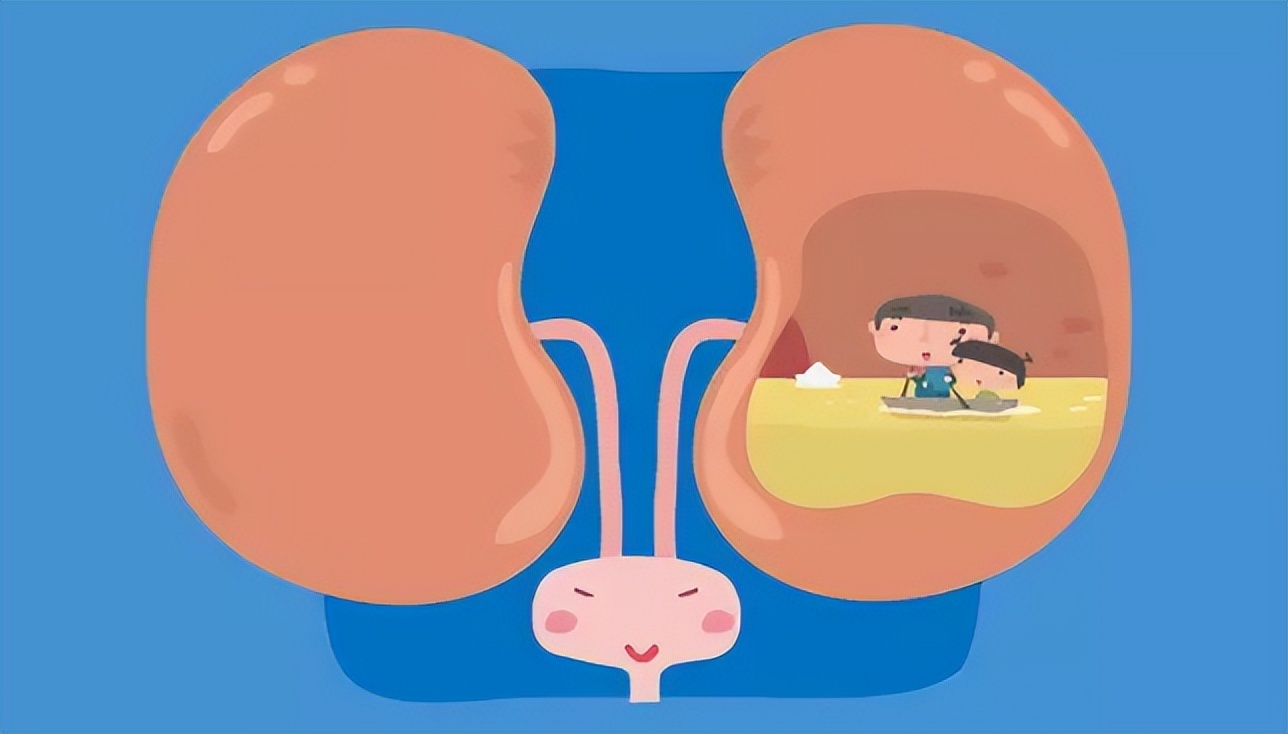 结石不用手术有特效药体外排石吗,有结石的不能吃哪些药物