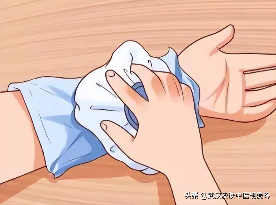 风团痒擦什么药膏好,风团很痒怎么办