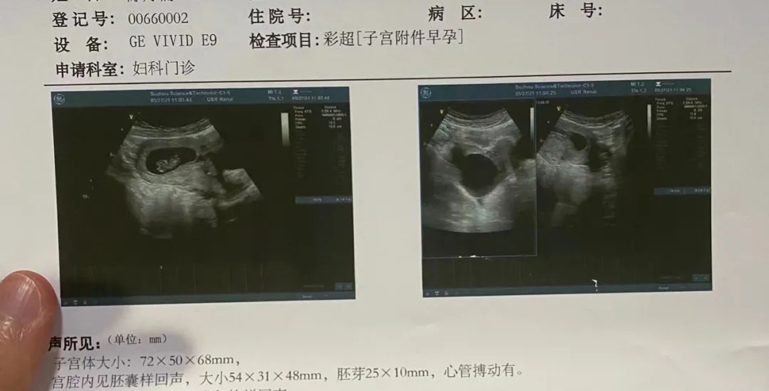 苏州二胎生孩子建档流程,苏州剖腹产3胎
