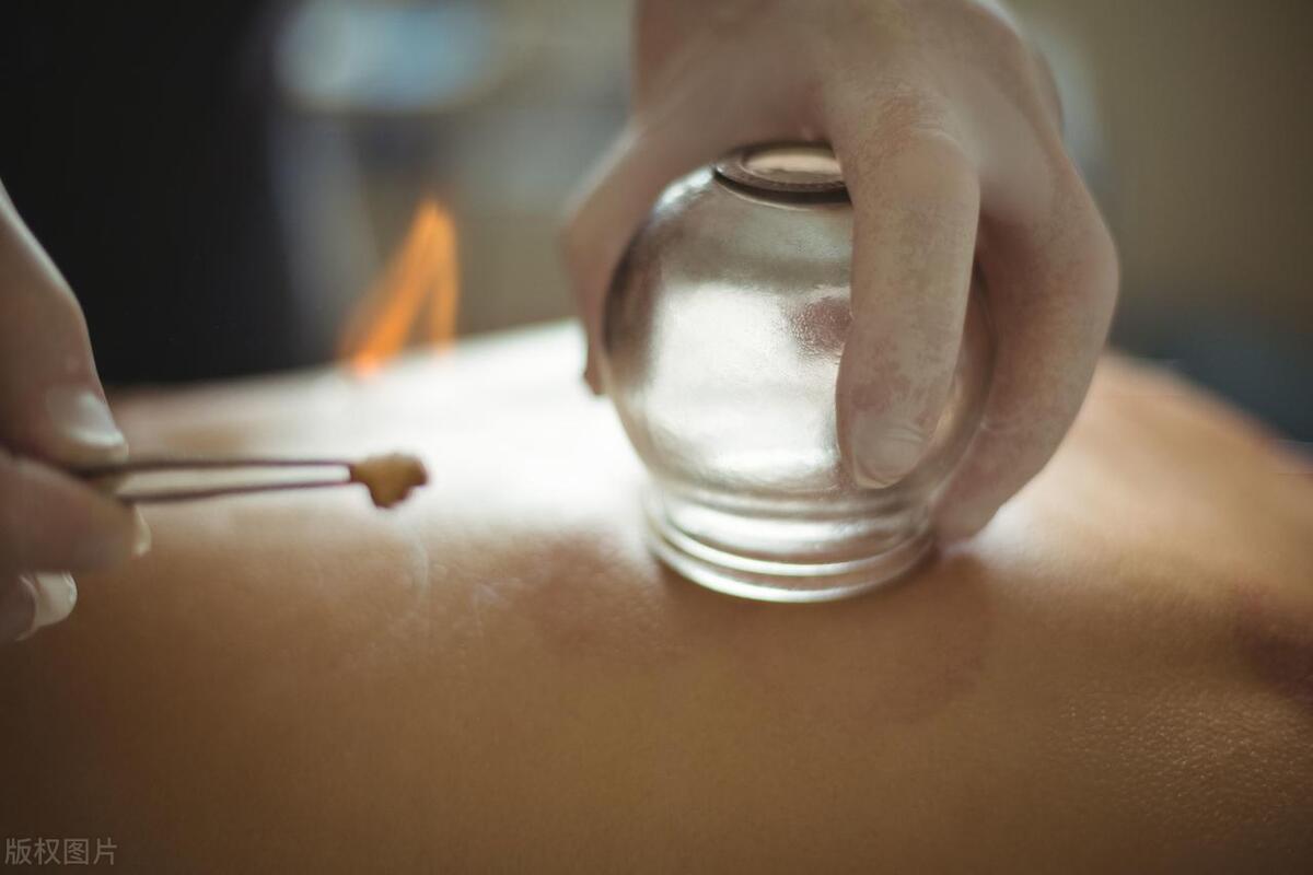 拔火罐的瘀血是身体内的毒素吗,拔火罐拔出的淤血是体内的毒素吗