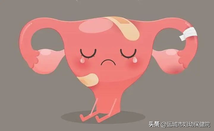 科普｜不能忽视的异常子宫出血