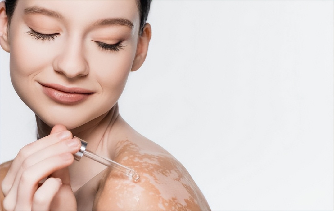 为什么外阴有一根白毛,女的外阴有好多白毛怎么治疗