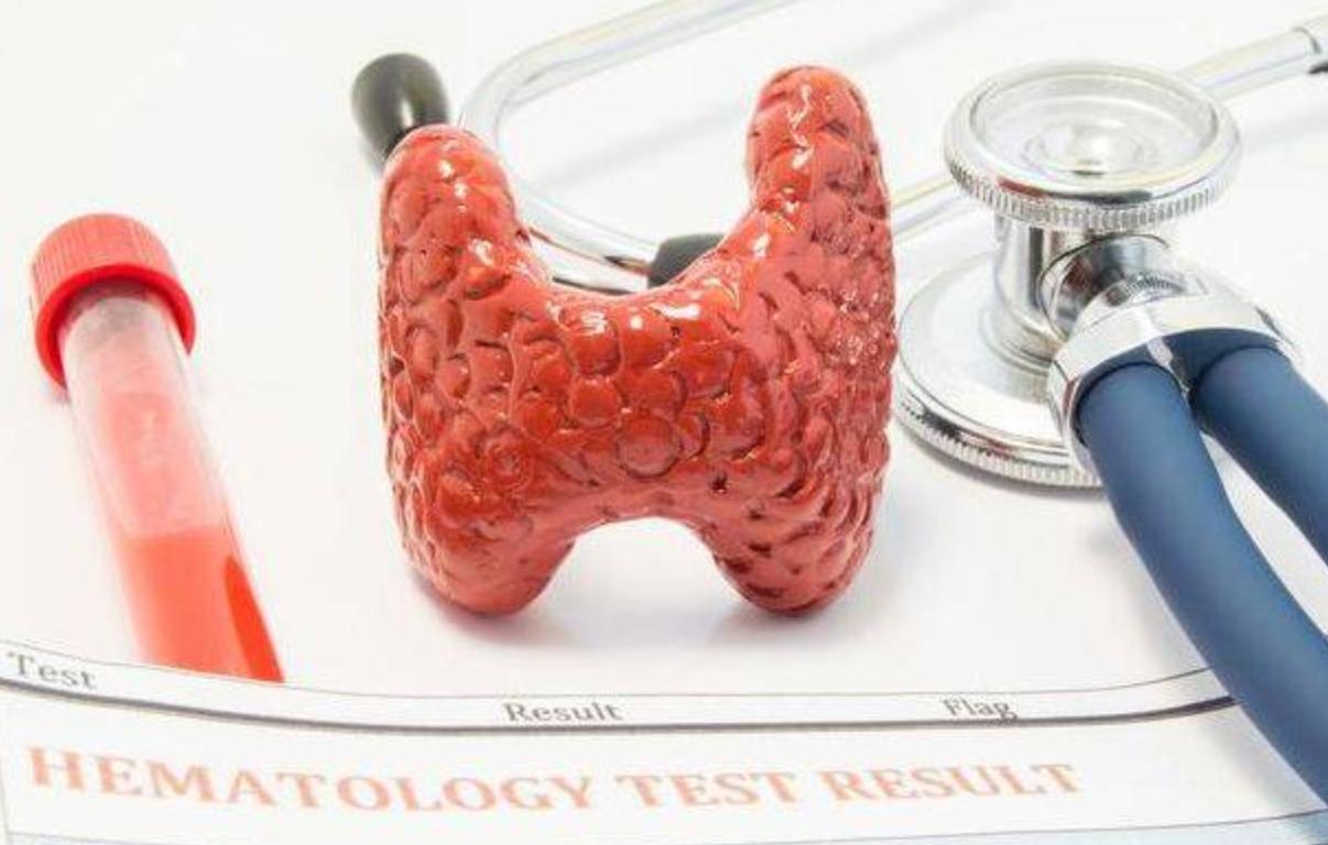 甲状腺引起的眼睛一大一小怎么办,得甲状腺眼睛突出该怎么治疗