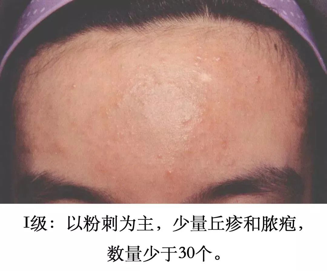 养成干净脸的最好方法,养成干净脸