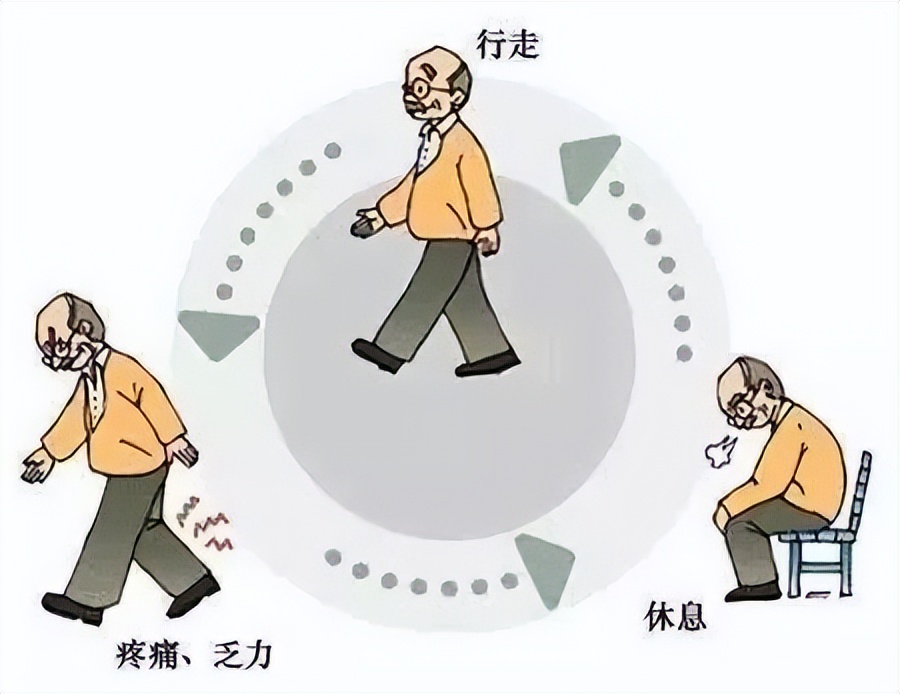 对于腰椎间盘突出症你真的了解吗,腰椎间盘突出的十个问题