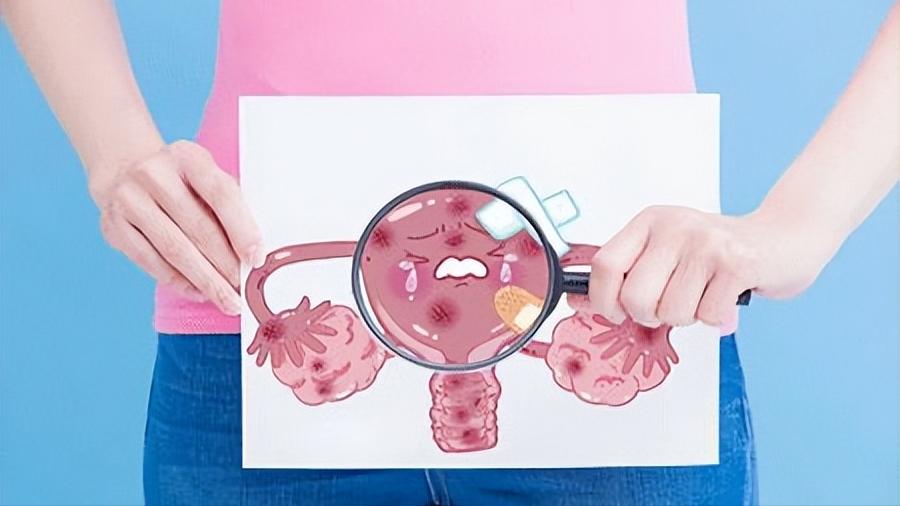 同房后疼痛出血，是伴侣的问题？这3种妇科疾病，男女都要注意