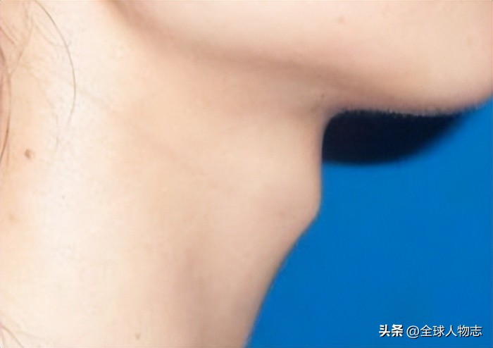 我，一个“双性人”，从小被当作“怪物”，如今成为女人获得新生