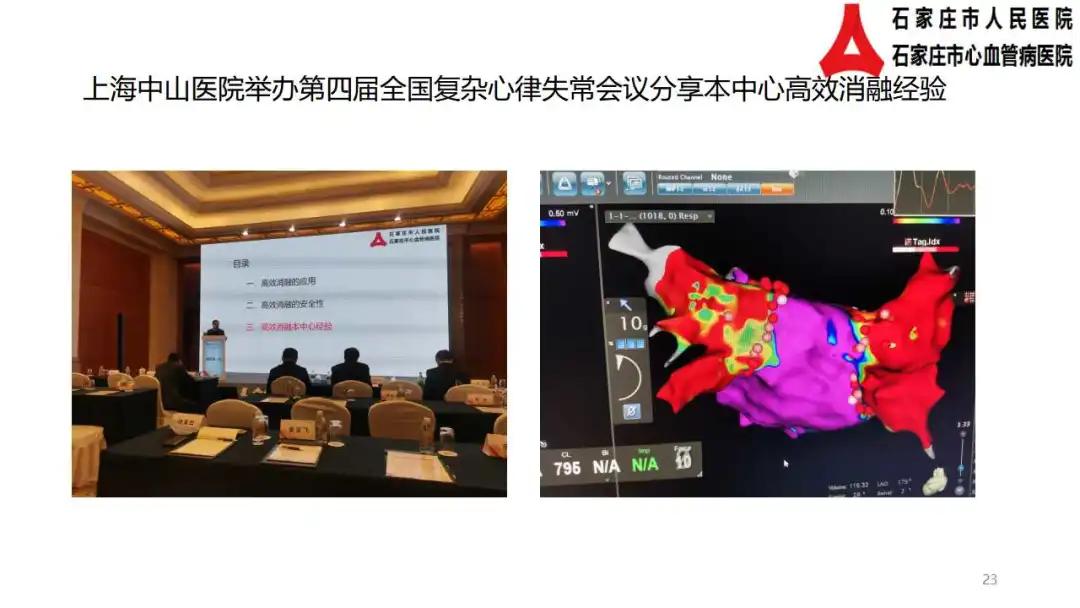 心房颤动如何治疗的,中药治疗心房颤动