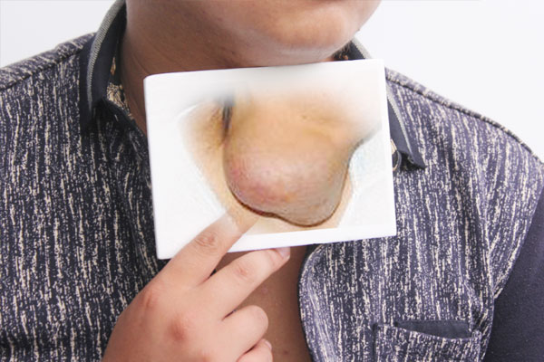 囊肿多大算正常是癌症吗能治愈吗,囊肿是良性还是恶性怎么区别