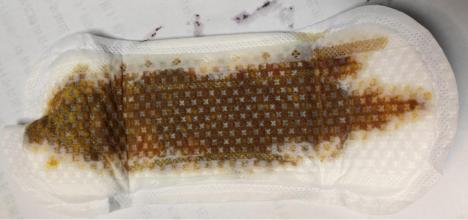 什么样的大姨妈,什么样的大姨妈才是正常