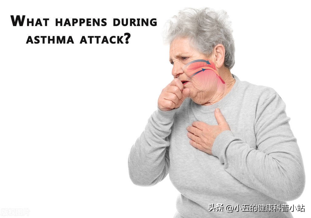 清肺哮喘药,滋阴润肺止咳平喘吃什么药