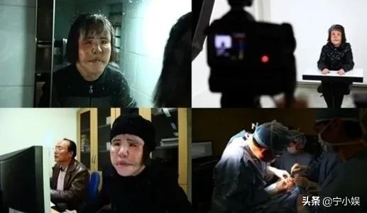 315晚会曝光医美行业三大乱象，难怪这4位明星，整容最终变毁容