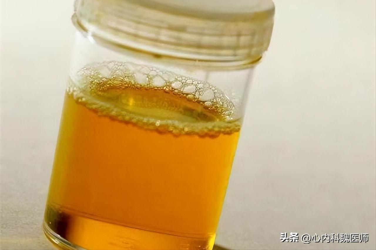 吃各种维生素对肝肾有伤害吗,维生素吃时间久了会造成肝损伤吗