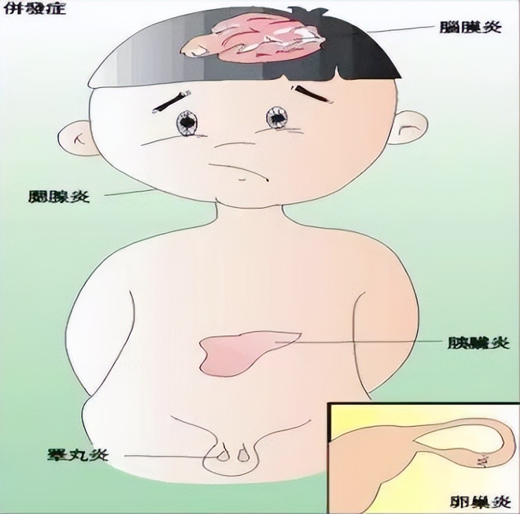 嘴巴张不开是什么综合症,嘴巴张不开是受凉引起的吗