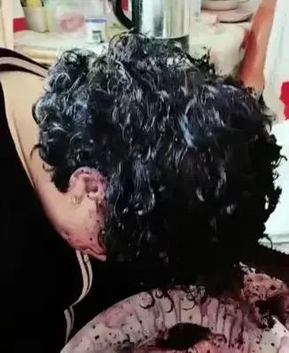 大妈用桑葚染发后续,大妈在家用桑葚染头发