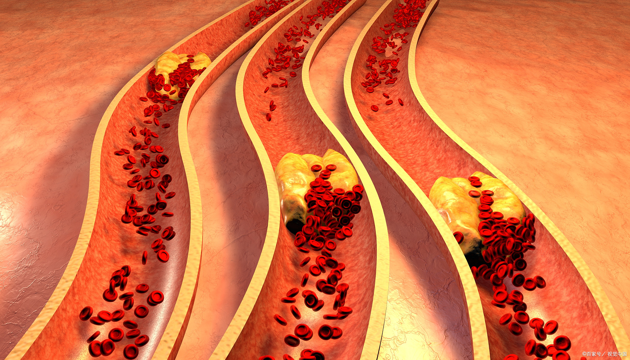 血瘀型失眠吃什么中成药,健脾益气的失眠中成药