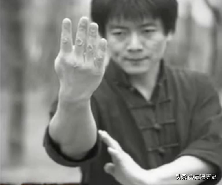 俄罗斯女孩中医治腿,俄罗斯女孩不会走路被中医治好