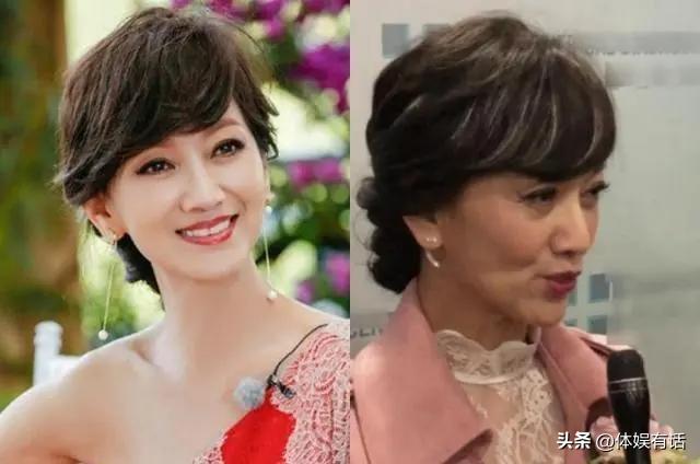 面部衰老皱纹图,面部衰老皱纹解剖图