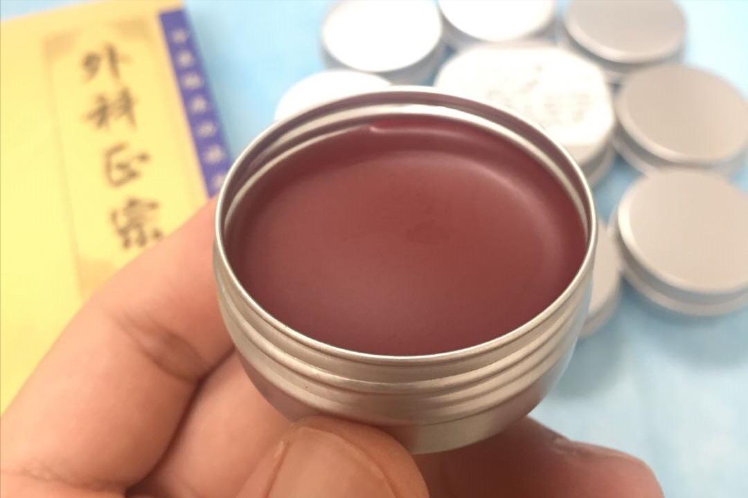 专家总结治疗肛裂的最佳治疗方式,治疗肛裂生肌的药