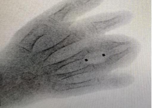 抗击疫情硬核技术,抗击疫情中的尖端技术