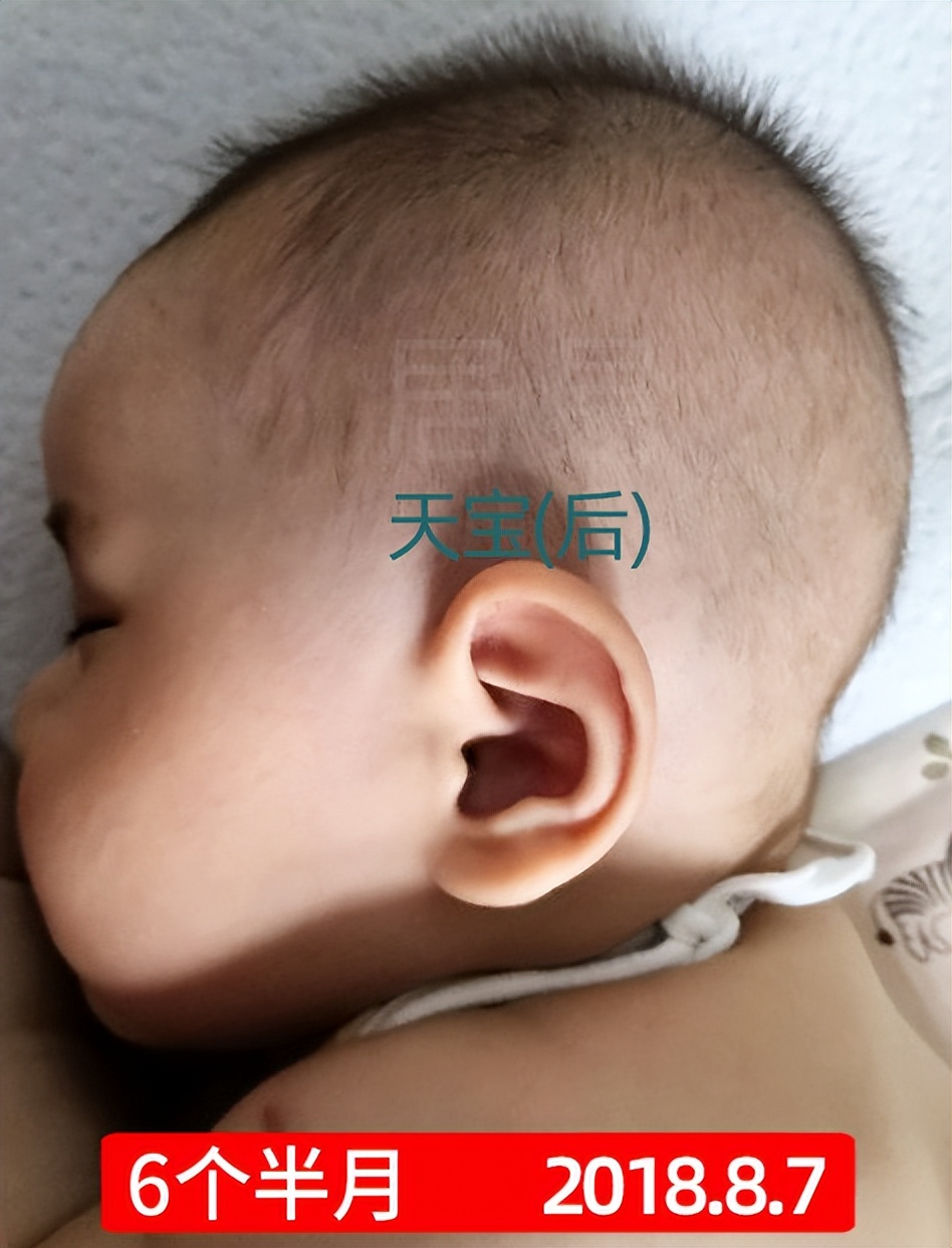 菱形头宝宝头型怎么矫正,上尖下扁头型宝宝头型怎么调整