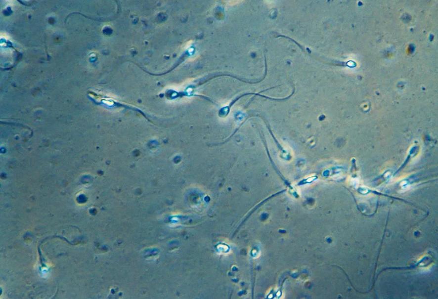 死精症是怎么造成的,死精症可以治好吗