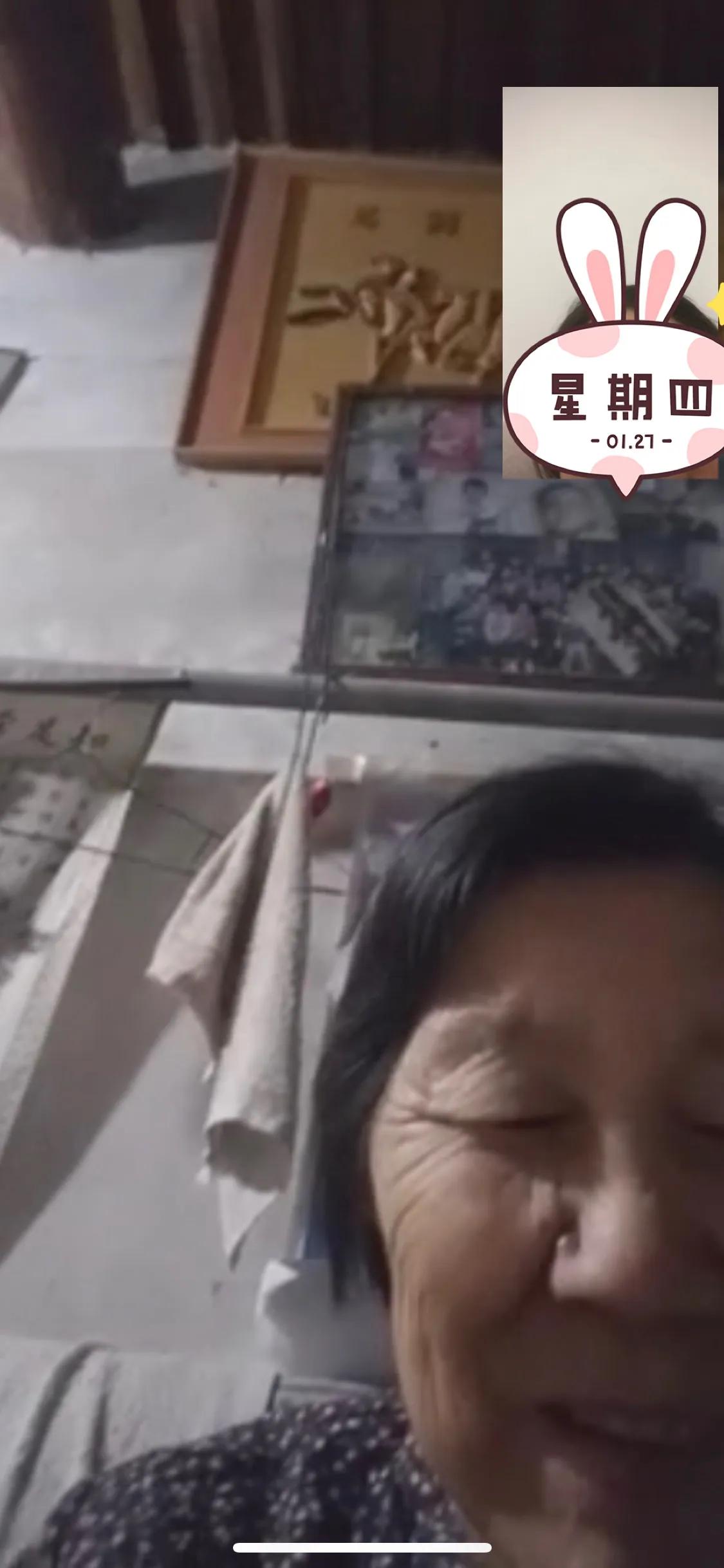 手被烫后起了一个大泡,手被烫个大泡