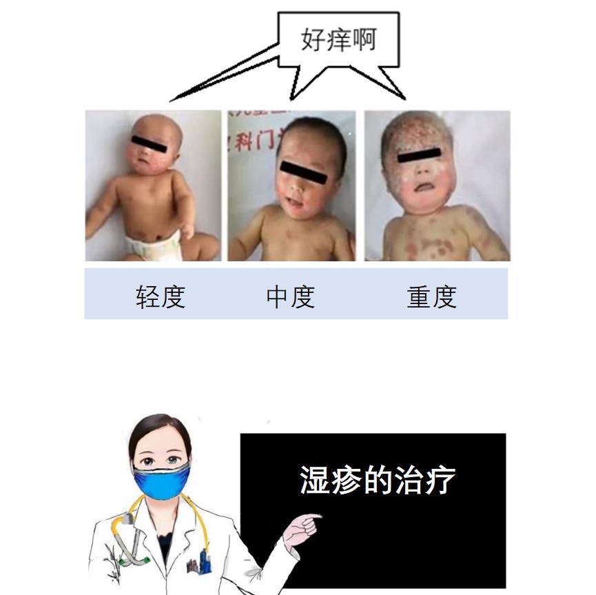 宝宝湿疹结痂如何护理,手湿疹怎么治疗和护理