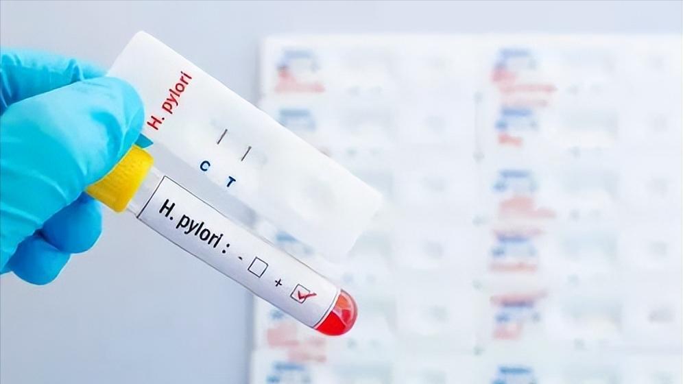 幽门螺杆菌感染阳性可以治好吗,幽门螺杆菌阳性是不是很严重