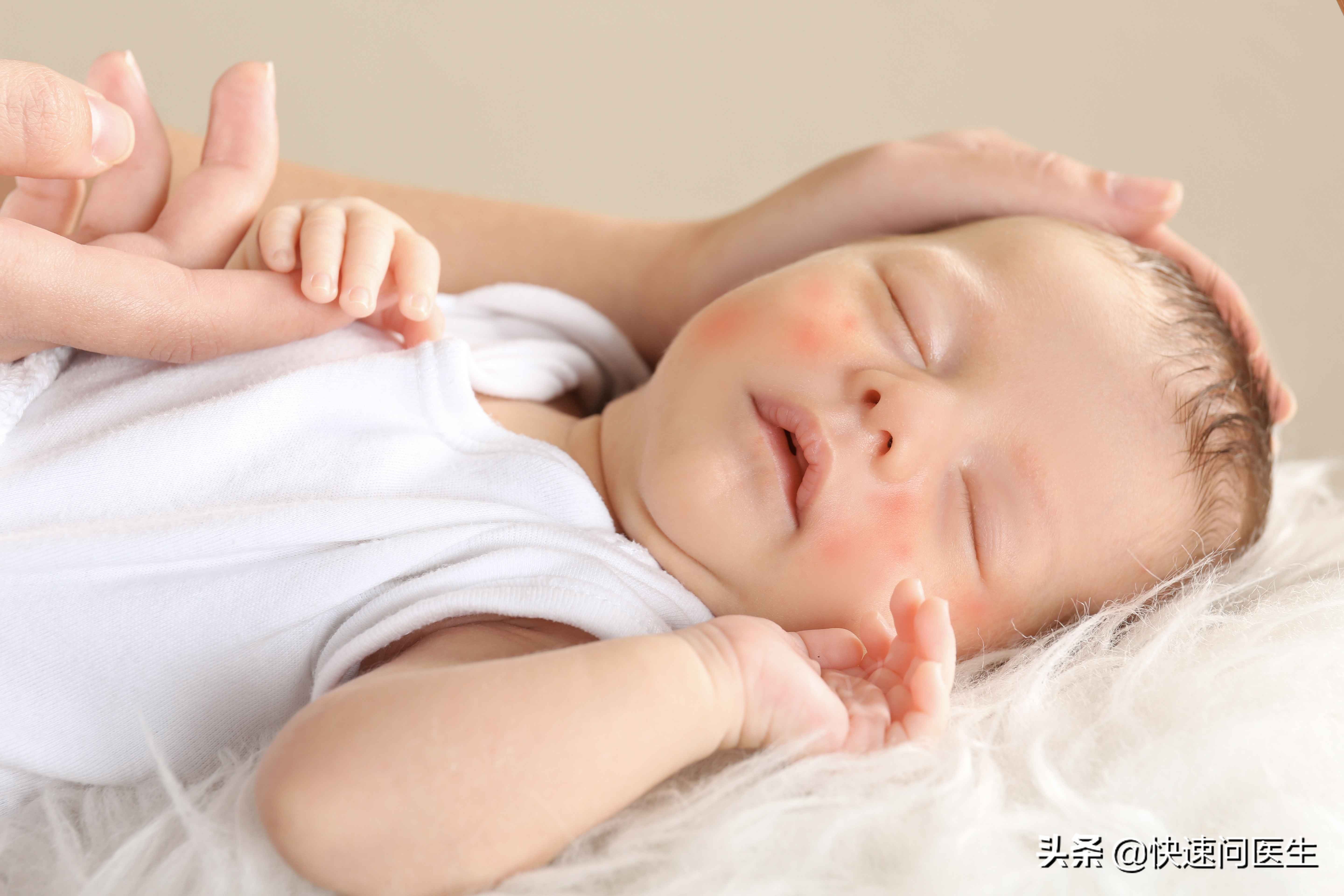 十个月宝宝身上起红疹,宝宝身上起红疹怎么办