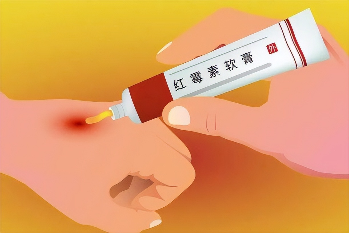 红霉素软膏副作用及注意事项,用红霉素软膏涂嘴唇要注意什么吗