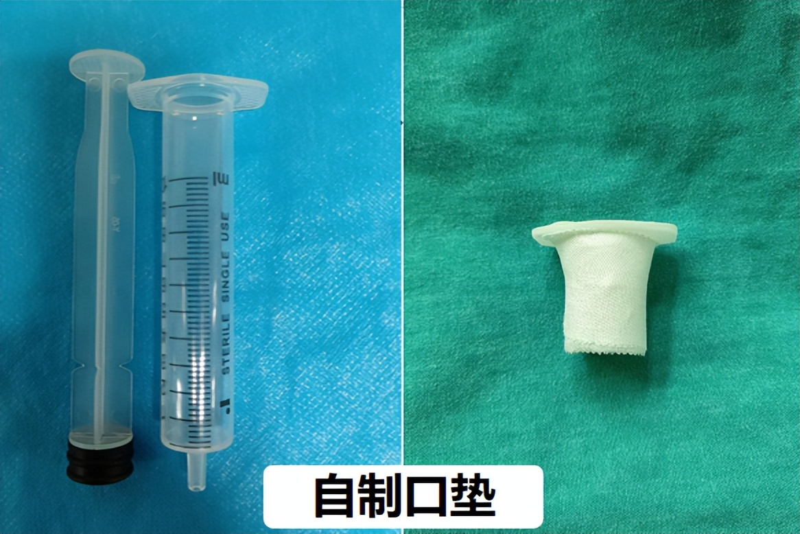 新生儿39天大口吐奶,35天的婴儿吐奶严重