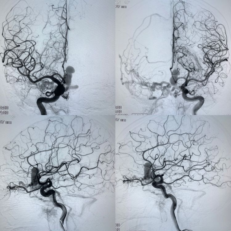 一个值得唠叨几句的病例