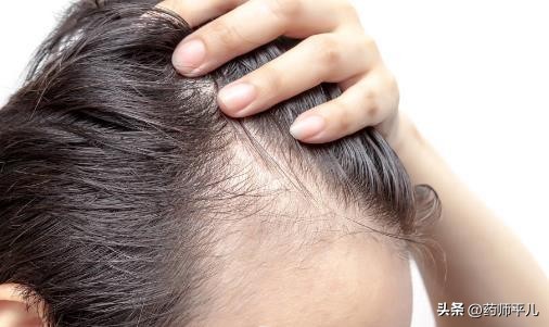 吃什么食物可以帮助头发由白转黑,如何保养头发关于头发的养生知识