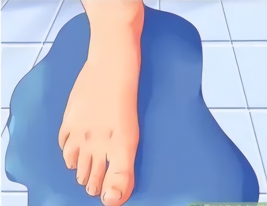 小孩子多大需要干预扁平足,8岁女孩扁平足需要干预吗