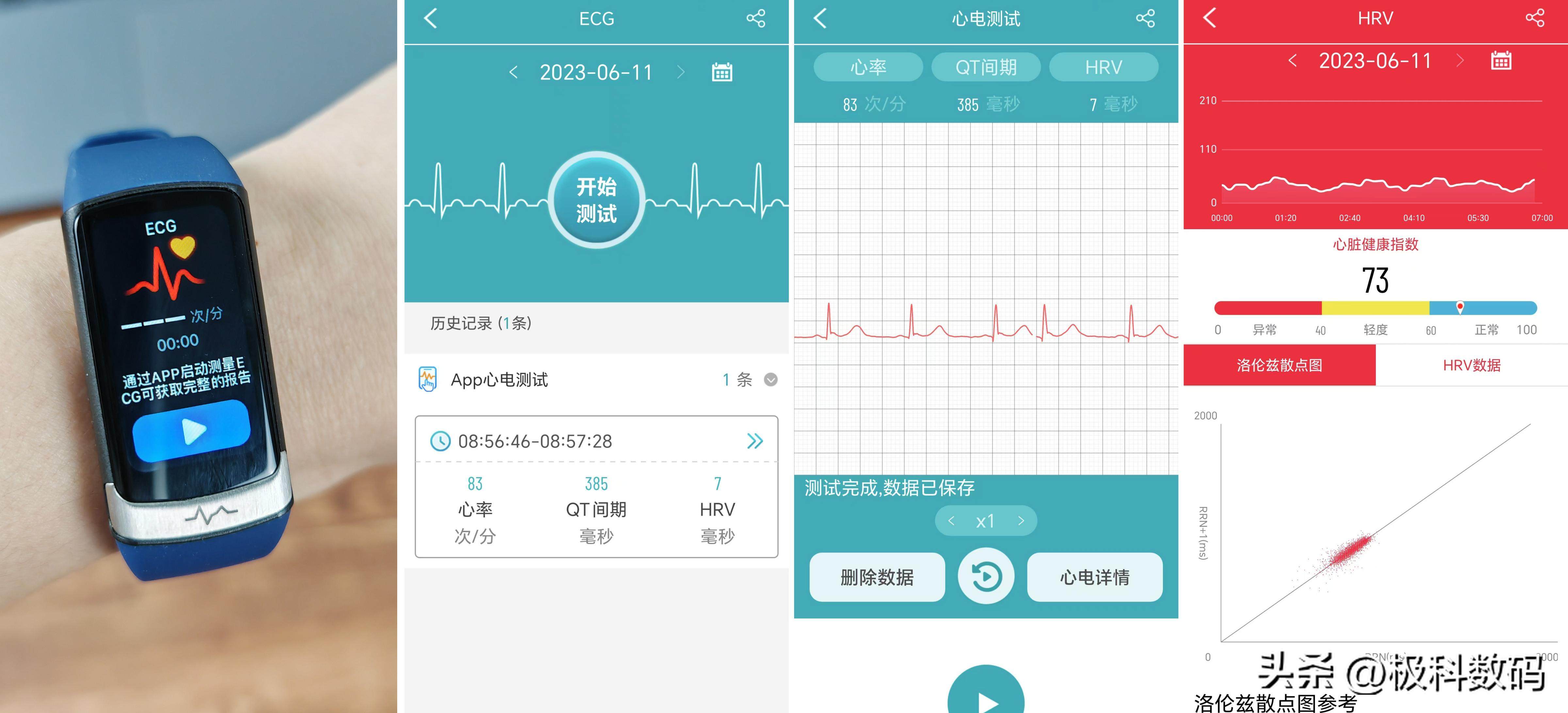 didoF50S智能手环使用体验，了解健康情况，高精度才实用！