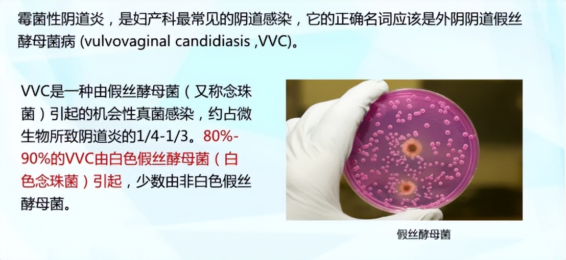 妇科检查这些坑不要踩,检查妇科病怎样避免踩雷