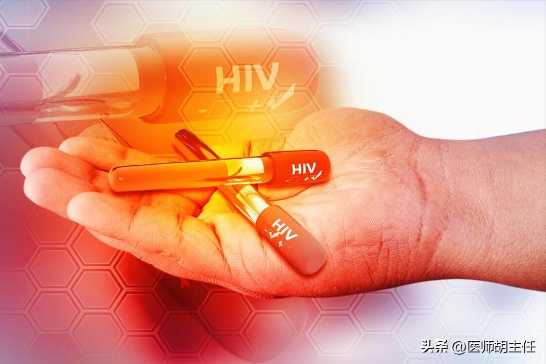 别把艾滋病当皮肤病治,不要错把艾滋病当皮肤病